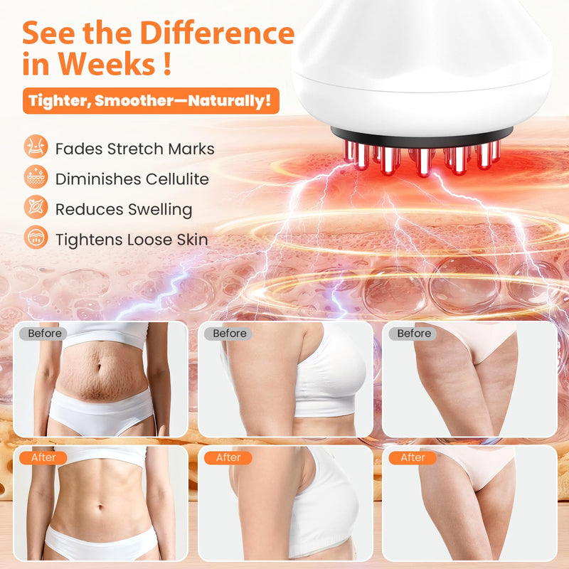[Australia - AusPower] - Body Sculpting Machine, Lymphatic Drainage Massager & Anti Cellulite Massage Tool, Helps Reduce Stretch Marks & Cellulite, Targeted Relief for Sciatica, Nerve, Hip, Joint & Muscle and Lower Back Pain 