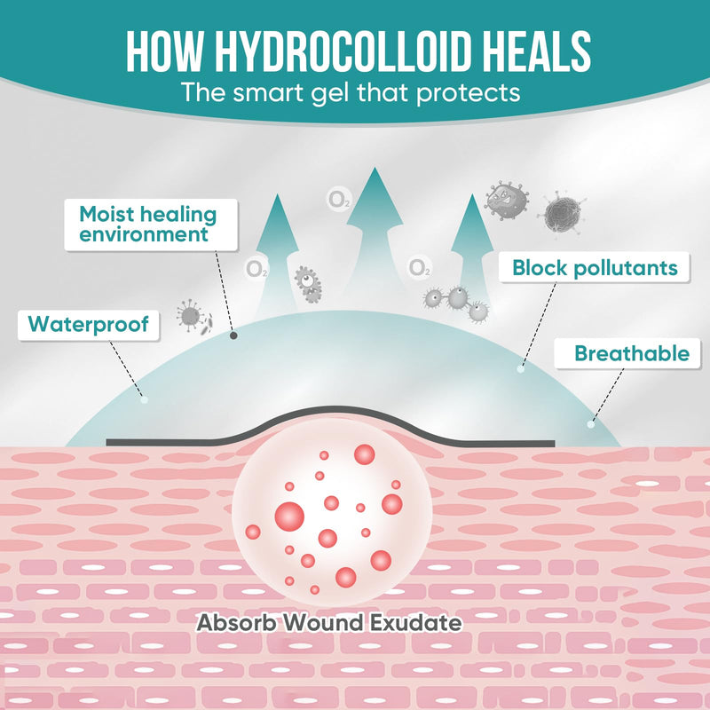 [Australia - AusPower] - Hydrocolloid Roll for Wound Care, Hydrocolloid Patch Bandages with Self-Adhesive, Bed Sore Bandages, Highly Absorbent for Burn, Blister, Acne Care, Sterile and Waterproof (2in x 12ft) 