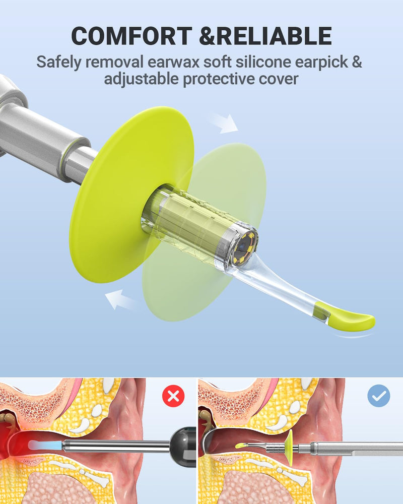 [Australia - AusPower] - Digital Otoscope Compatible with iPhone and Android Devices, Ear Pick for Digital Otoscope with Light 
