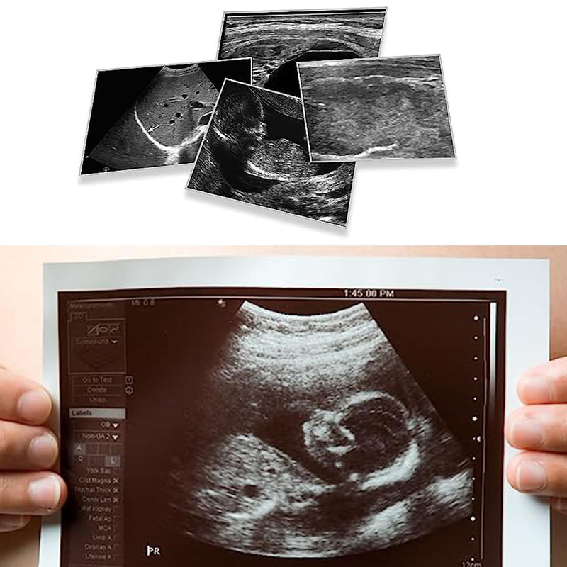 [Australia - AusPower] - UPP-110HG Ultrasound Paper Compatible for Sony, 2 Roll High Gloss Ultrasound Thermal Print Film/Media 110mm x 18m 