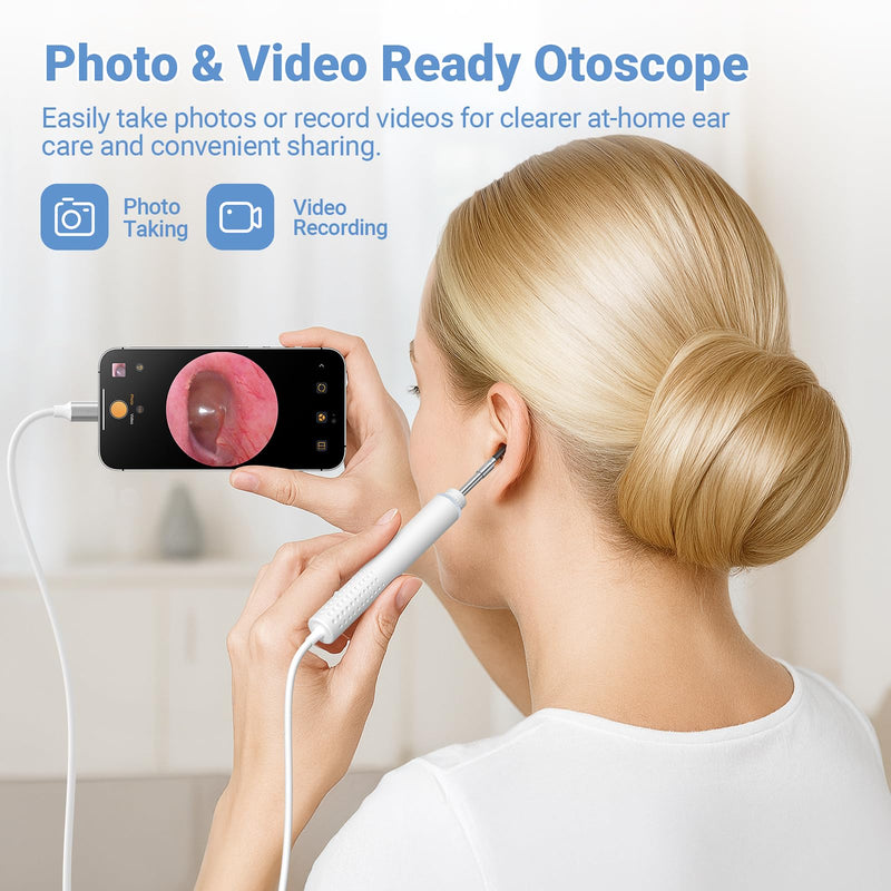 [Australia - AusPower] - ScopeAround Otoscope with Light, 720P HD Ear Cleaning Camera & 6 LED Lights Ear Scope, Digital Otoscope with Camera, Smart Endoscope, Plug & Play, USB-C Port 