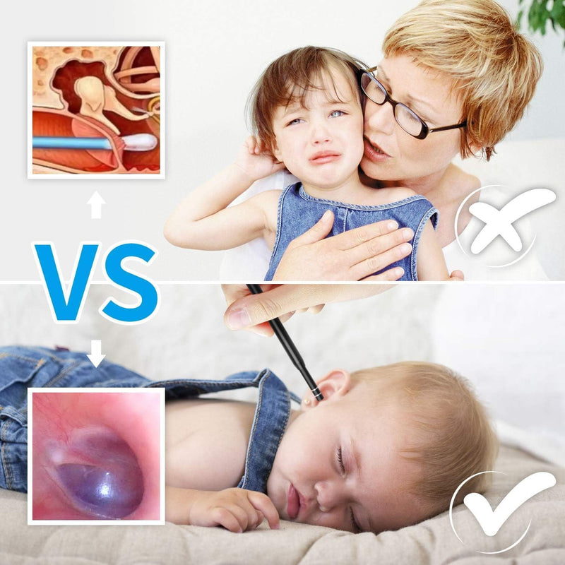 [Australia - AusPower] - 3in1 USB Otoscope-Ear Scope Camera, Mini New Upgraded 5.5mm Diameter Visual Ear Camera HD Ear Endoscope with Earwax Cleaning Tool and 6 Adjustable LED Lights for OTG Android and Windows & Mac. 