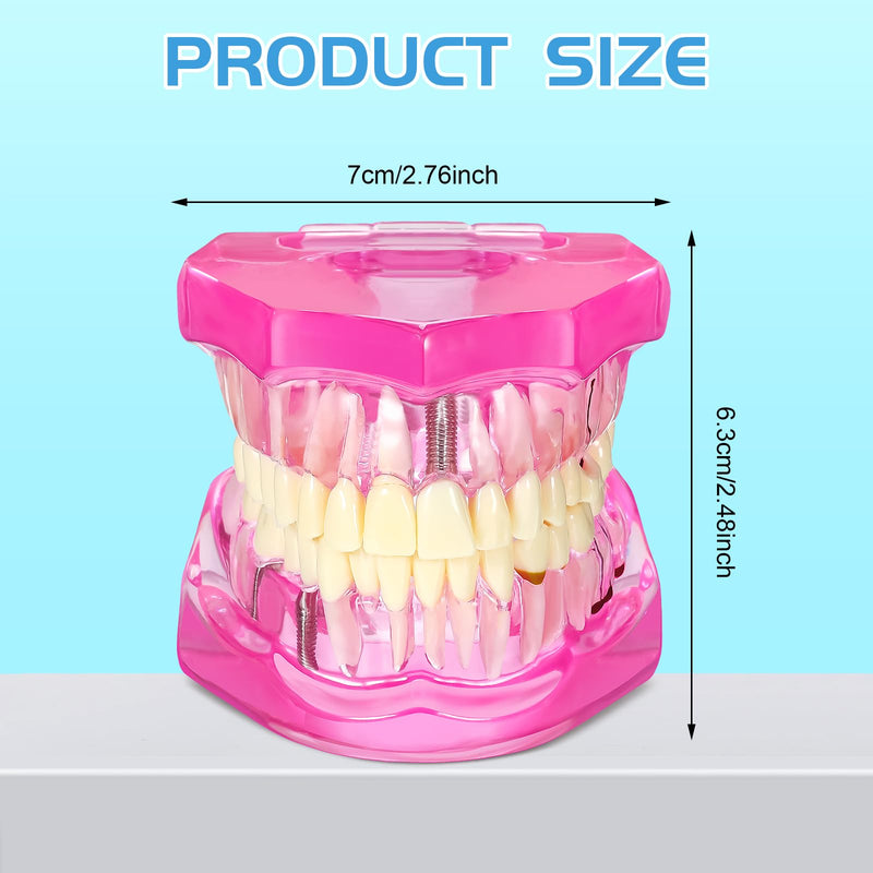 Outus Disease Teeth Model Dental Implant Typodont with Removable Tooth Dentist Standard Tooth Pathological Demonstration for Back to School Education Dental Supplies(Pink,2 Pcs) 2 Pink