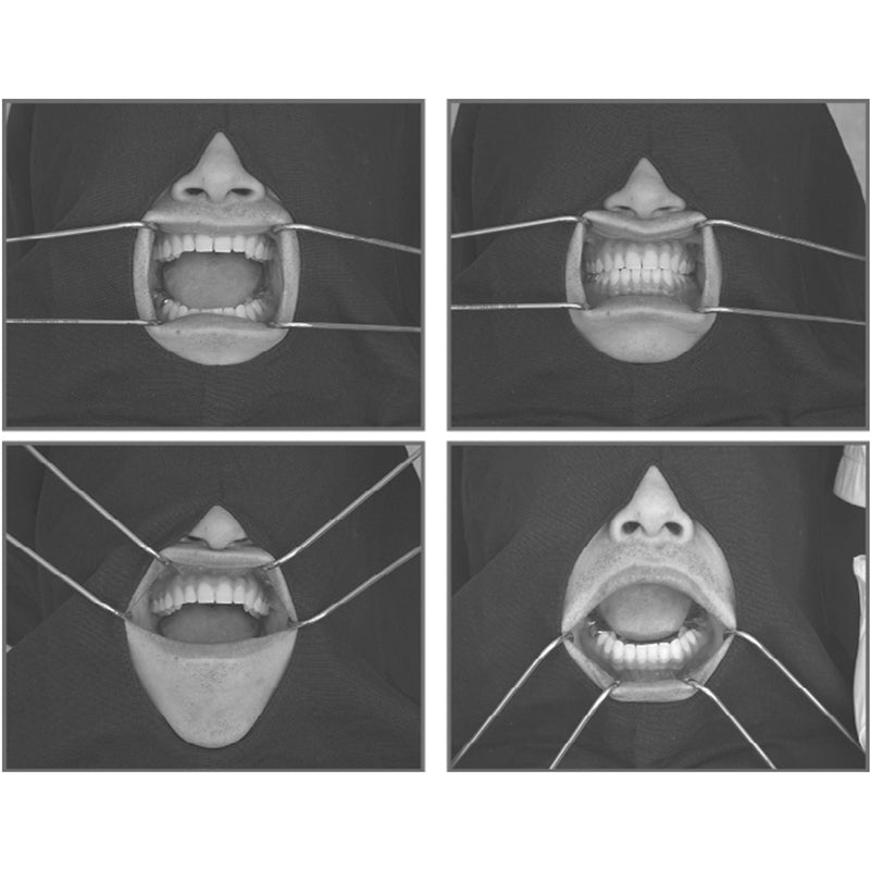 [Australia - AusPower] - Dental Columbia Cheek Retractor Autoclavable Mouth Opener Stainless Steel Instrument Teeth Whitening RTCRC 2 pc set 