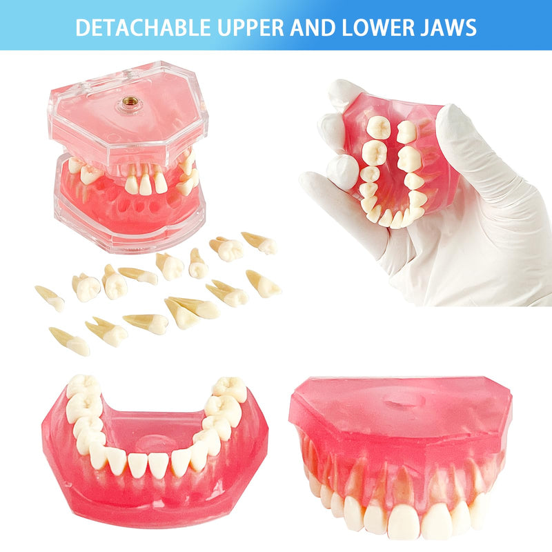 [Australia - AusPower] - Standard Study Teaching Dental Model with All Removable Teeth - Soft Silicone Gel Gum and Bendable Teeth Typodonts for Students and Professionals - Ideal for Dental Education and Demonstrations 