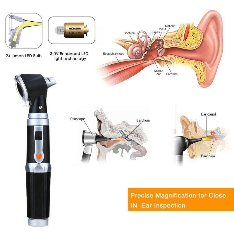 [Australia - AusPower] - Otoscope Kit,Professional Diagnostic Ear Care Tool with 3.0V LED Bulb, 3X Magnification, 4 Speculum Tips Size - for Children, Adults, Pets, etc. 