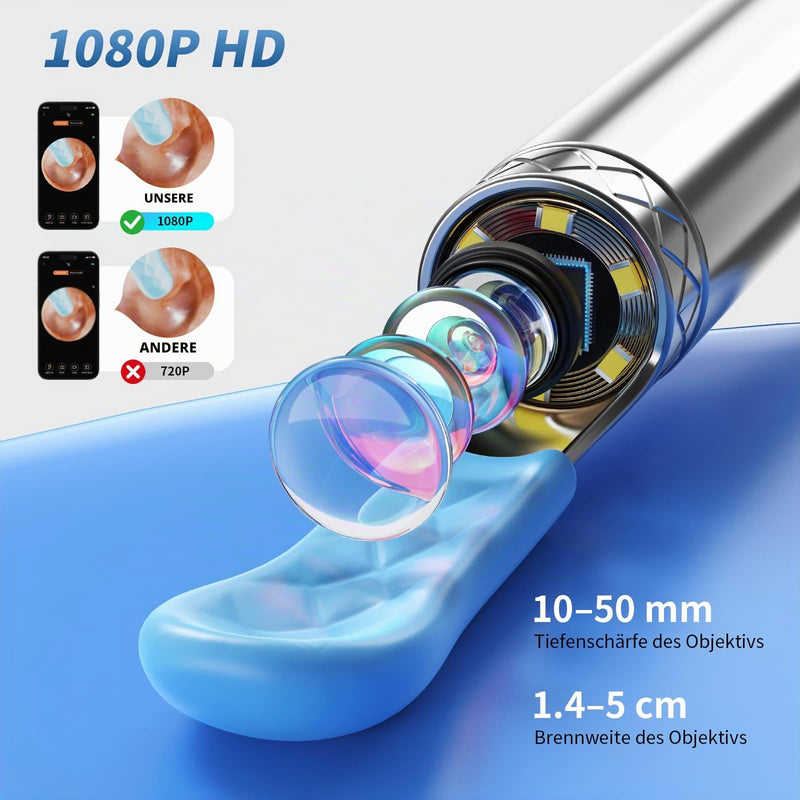 Qimic Visual Ear Cleaner with WiFi, IP67 Waterproof and 360° Wide Angle Camera with 6 LEDs for Adults and Children, Black