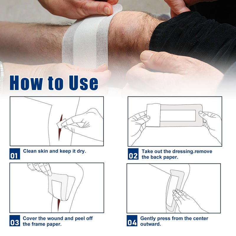 [Australia - AusPower] - Island Dressing Bordered Gauze 4"x10", 25 Individually Packed Non-Stick Pad in Center with Adhesive Border,Soft & Highly Absorbent Medical Grade Dressing Gauze Pad for Wound Care and First Aid 