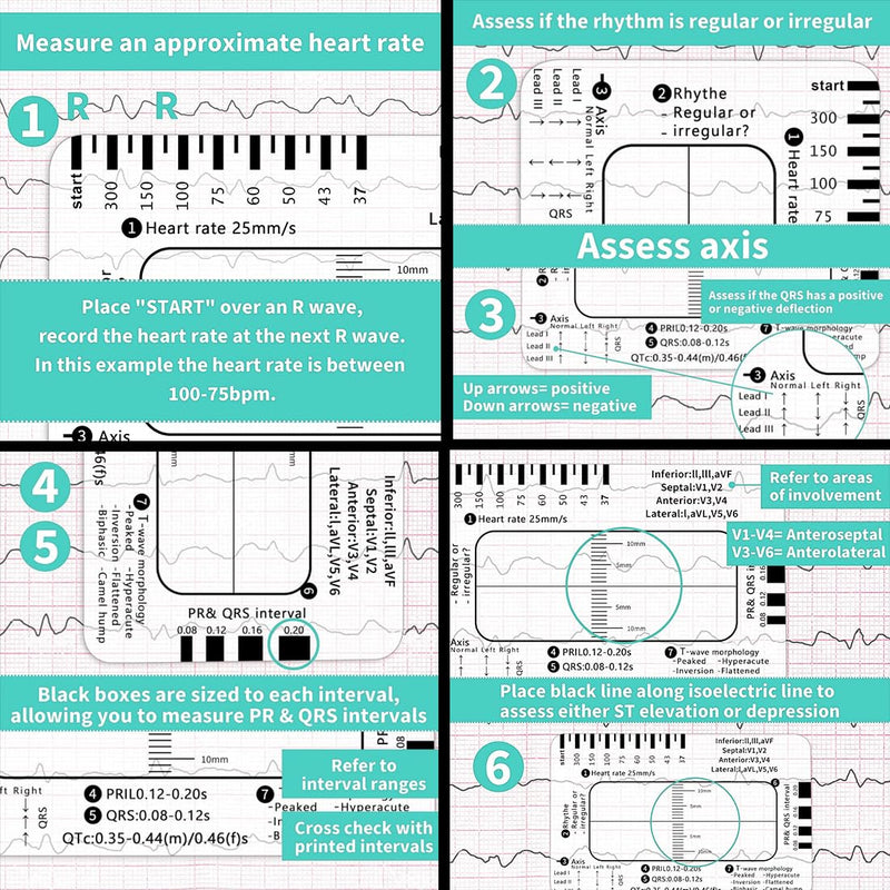 ECG 7 Level Ruler Card for ECG/ECG Interpretation, Portable Bag, Plastic, 85.6 mm x 53.98 mm, Medical Instrument, Simple Plastic Construction, ECG 7 Step Ruler, Pack of 2