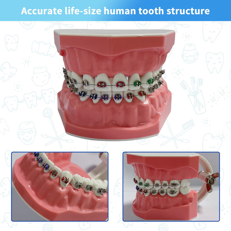 [Australia - AusPower] - Orthodontic Dental Model with Brackets for Educational Demonstration - Silicone Teeth Typodont with Braces, Anatomic Teaching Tool - Dental Care Training Device for Students and Patients 