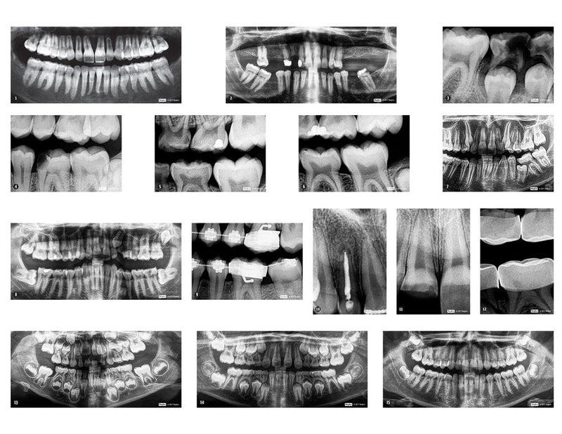 [Australia - AusPower] - Dental X-Rays 