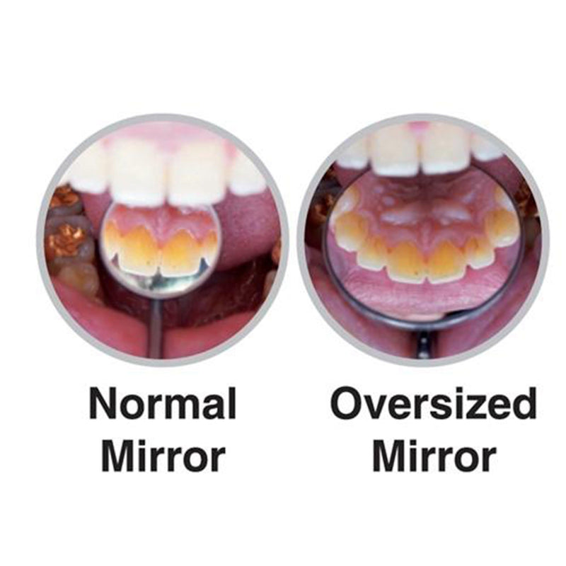 [Australia - AusPower] - DMS39 Dental Tiltable Mouth Mirror, Oversize 