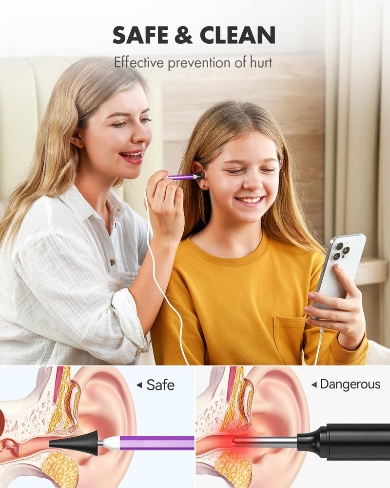 [Australia - AusPower] - Anykit Digital Otoscope with Gyroscope, HD Ultra Clear View Ear Camera with Ear Wax Removal Tools, Video Ear Scope Otoscope with Light, Compatible with Android, iPhone 15 (Purple) 