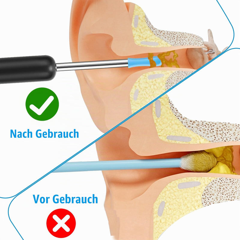 cobee Ear Wax Removal Replacement Tips for Ear Camera, Ear Spoon Tips, Silicone Ear Spoon Replacement Tips, Ear Cleaner Replacement for Adults, Earwax Removal Endoscope (60) | Ear Spoon Tips Silicone Ear Spoon Replacement Tips Ear Cleaner Replacement f...