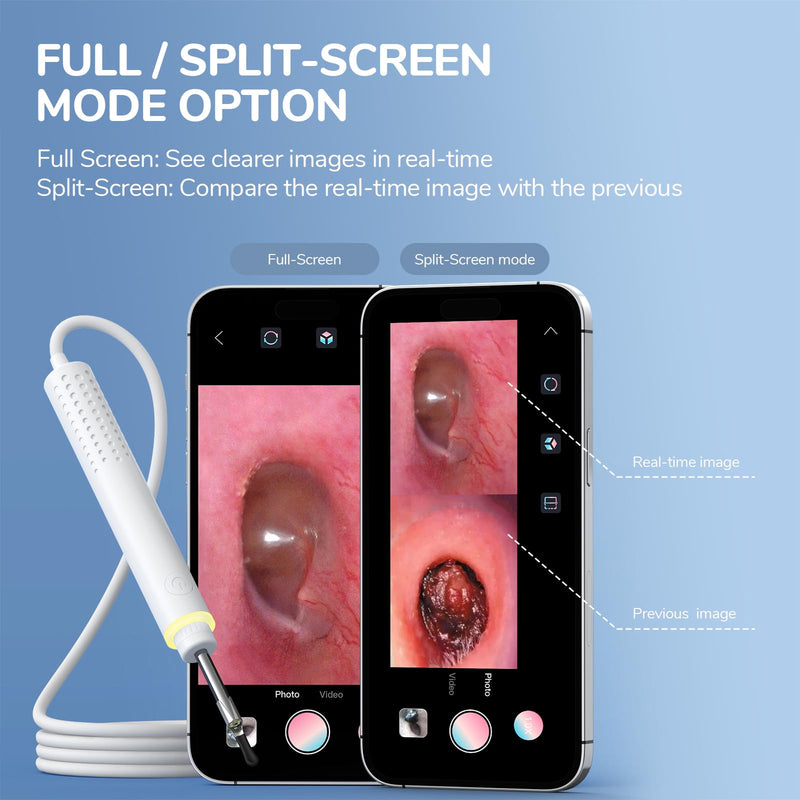 Otoscope Compatible with iPhone 15/Android, ScopeAround 3.9mm Ultra-Thin Ear Camera with 6 LED Lights,Digital Otoscope with Ear Wax Removal Tool,USB Plug & Play Ear Wax Camera for Android