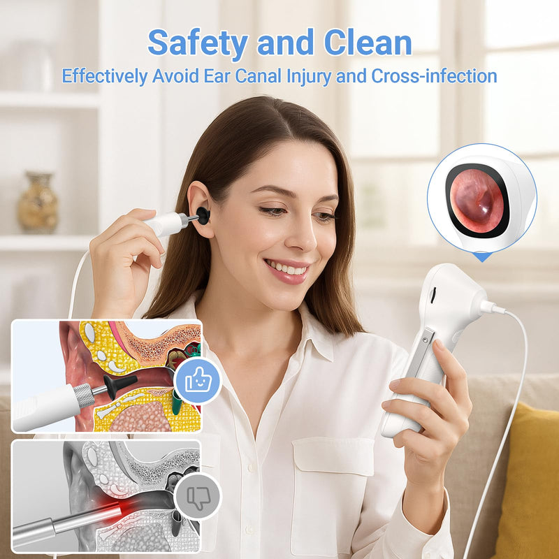 [Australia - AusPower] - ScopeAround Otoscope with Light, 720P HD Ear Cleaning Camera & 6 LED Lights Ear Scope, 1.45" IPS Display Digital Otoscope, Ear Scope with Extention Cable, Smart Ear Camera, Ready to Use White 