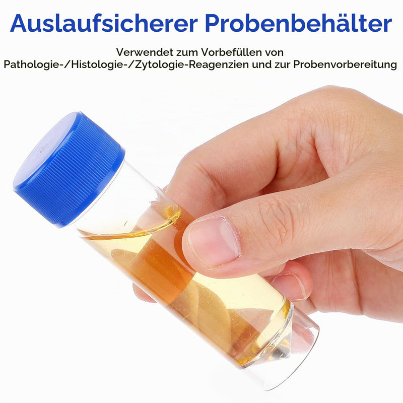 Hemobllo Sample Cup with Screw Lid, Samples Container Without Label Laboratory Medical Use 25-30 ml Pack of 10