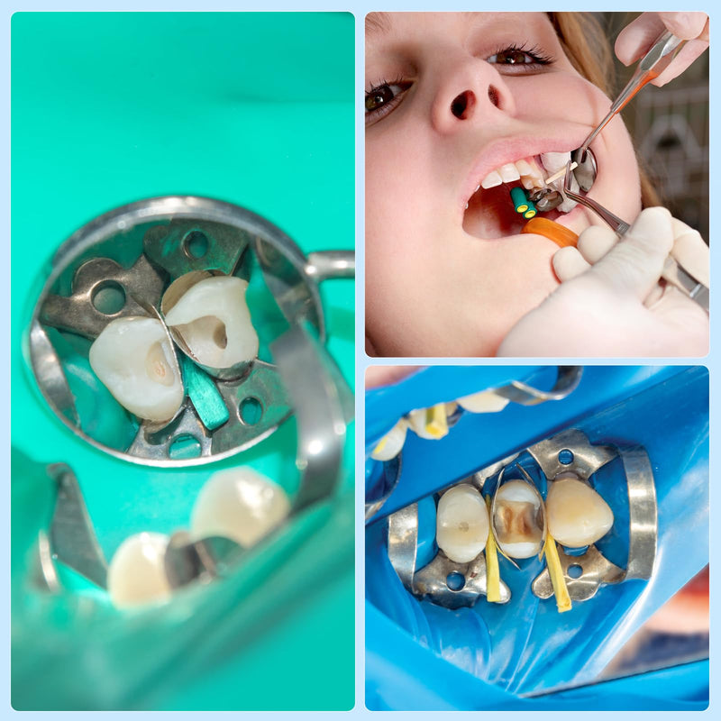 [Australia - AusPower] - JMU Dental Wooden Wedges 100Pcs Disposable Colorful Wooden Wedges (White (1.3x1.5x14mm)) White (1.3x1.5x14mm) 