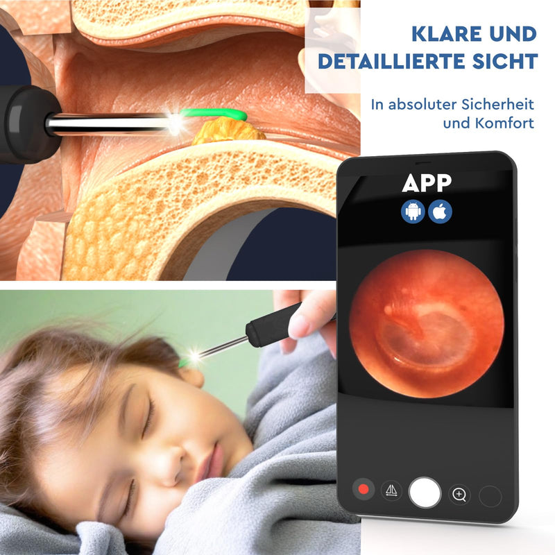 Ear Wax Remover Otoscope with Camera 1920p 3.6 mm WiFi Ear Cleaner - UdiGuard Ear Mirror Ear with 6 LED Lights Dogs Adults and Children - Compatible with iPhone iPad Android Black Udiguard Black Otoscope