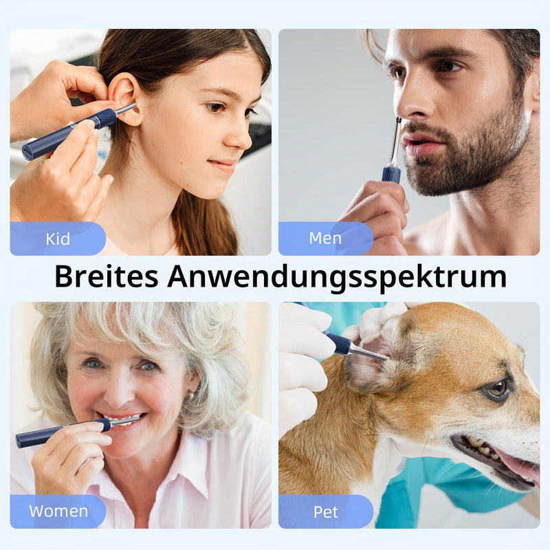 Qimic Ear Wax Remover, 1080P HD WiFi Ear Cleaner, Ear Camera with Tweezers & 4 LEDs, Otoscope for iOS & Android, IP67 Waterproof Ear Cleaner for Adults, Children and Pets