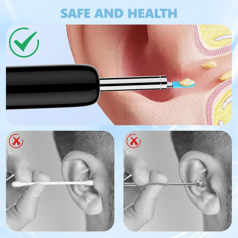 Pack of 50 Silicone Ear Cleaner Heads for Earwax Remover, Replacement Tips for Ear Camera, Ear Spoon Accessories for Ear Suckers, Earwax Sucker Ear Cleaner Accessories