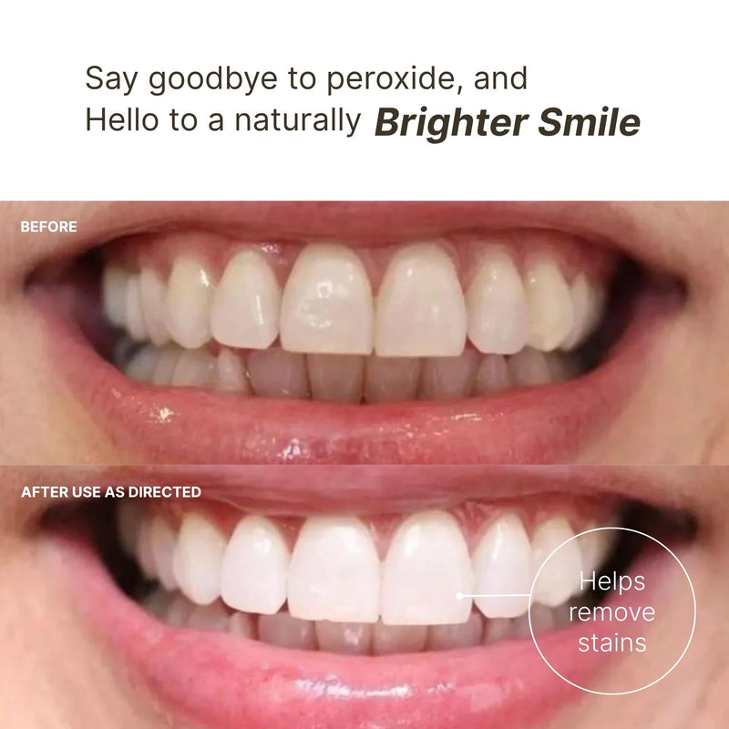 Nu Skin AP 24 Whitening Fluoride Toothpaste | AP 24 Blend | Vanilla Mint Flavor | Brightens Teeth | Removes Surface Stains | Prevents Dental Cavities & Plaque | Enamel-Safe | 4 oz | 1 Pack