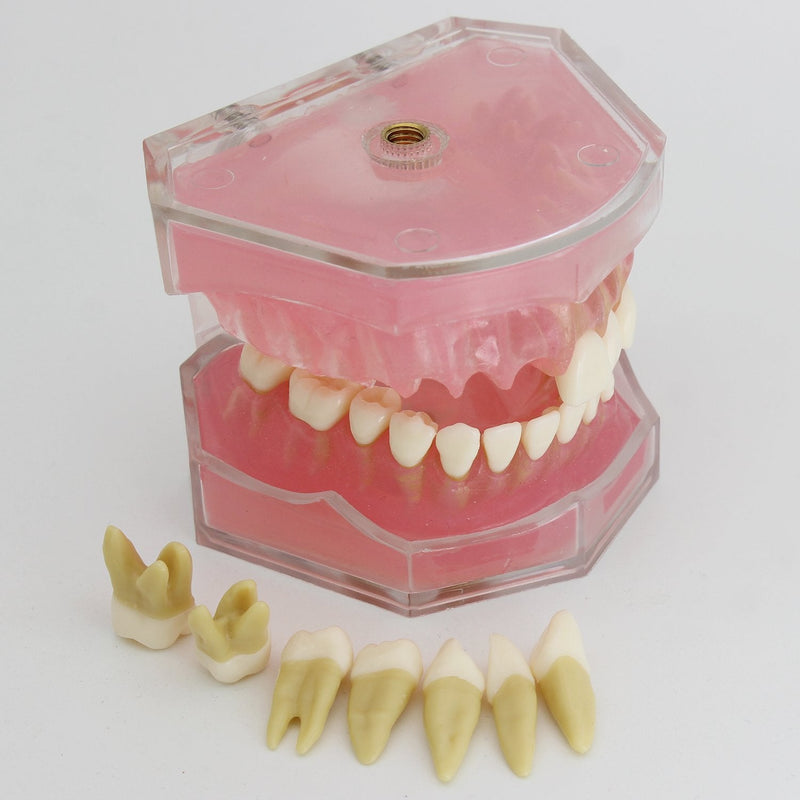 [Australia - AusPower] - Dental Implant Teeth Model Study Teach Standard Model with Removable Teeth 