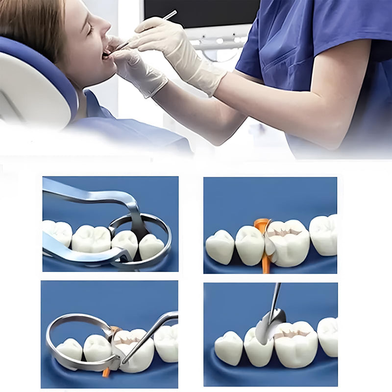 [Australia - AusPower] - 100 Pieces Stainless Steel Sectional Contoured Metal Dental Matrices Kit with Ledges, 0.035mm Thickness, Assorted Sizes Soft Metal Bands for Molar and Premolar Restorations - Dental Matrix System Kit 