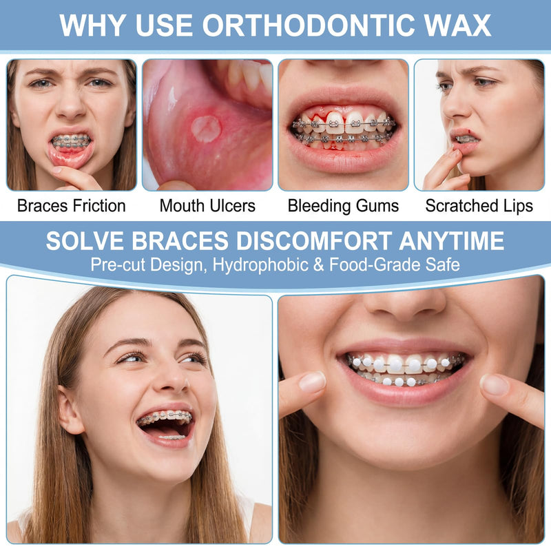 9 Boxes of Braces Wax, Pre-Cutting Wax for Braces, Relieves Irritation and Pain Caused by Friction of Braces (White, Pink, Blue)