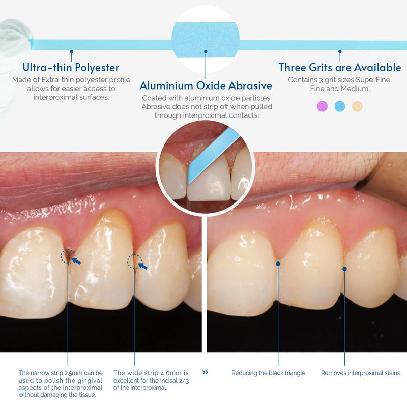 [Australia - AusPower] - Dental Polishing Strips - Fine Grit (30μm), 4mm Wide × 6m Long Roll, Blue Color - Abrasive Strips for Teeth Polishing & Interdental Finishing - Safe for Professional & Home Use 