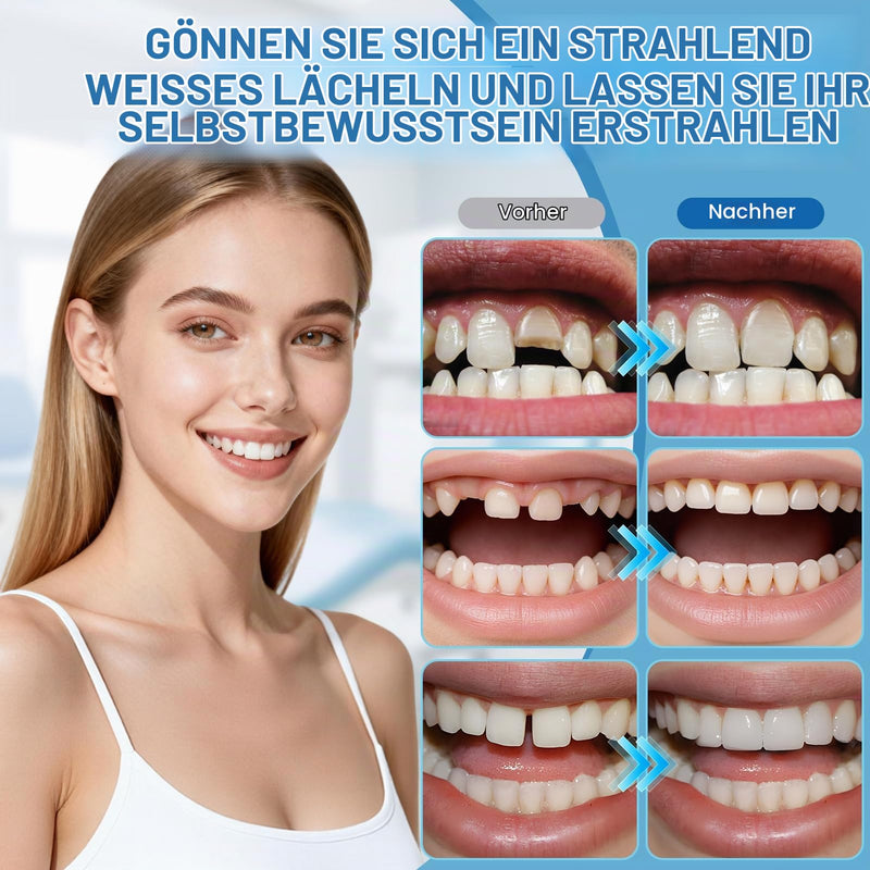 Dental cement self-hardening durable, tooth adhesive for crowns | Tooth filling, self-hardening, durable, denture adhesive, solution for crowns, bridges, dental caries and lost fillings