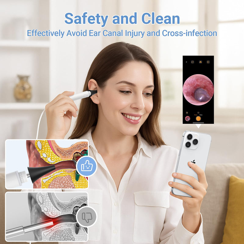 [Australia - AusPower] - ScopeAround Otoscope with Light, 720P HD Ear Cleaning Camera & 6 LED Lights Ear Scope, Digital Otoscope with Camera, Smart Endoscope, Plug & Play, USB-C Port 