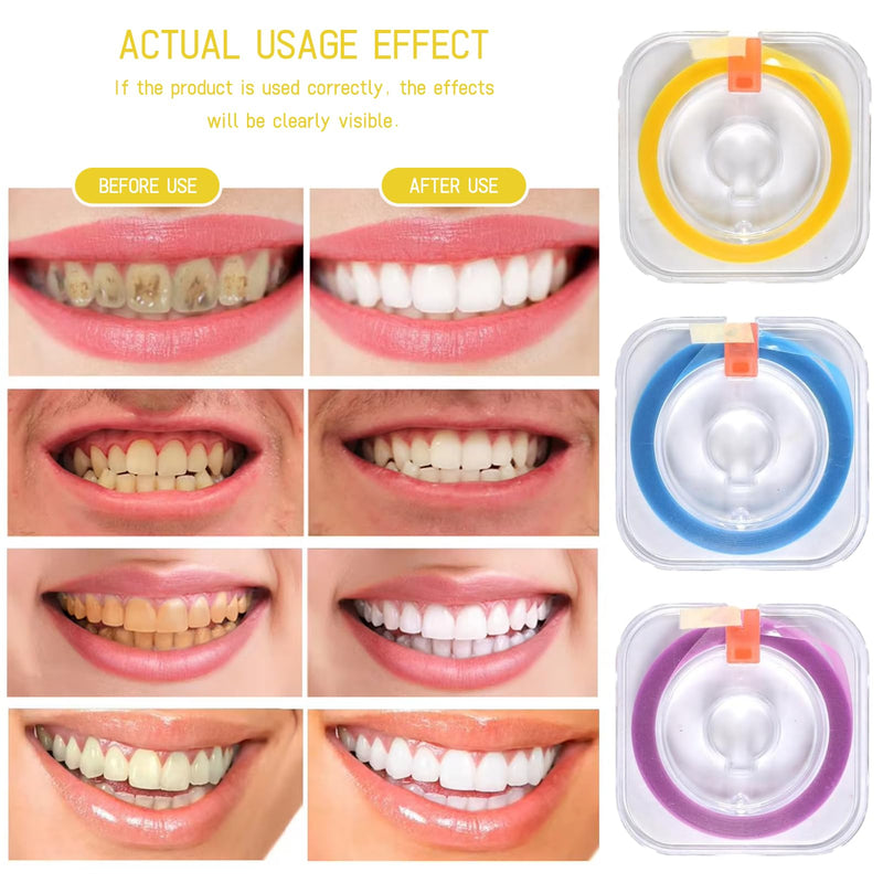 3 Rolls Tooth Polishing Strips 4mm x 6m | Sanding strips for interdental spaces and professional applications; use only according to professional instructions.