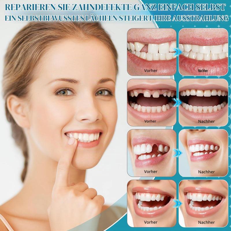 Dental cement self-hardening durable, fast curing | Dental adhesive for crowns, dentures glue, solution for crowns, bridges, dental caries and lost fillings