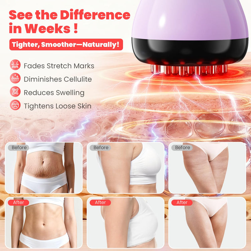 [Australia - AusPower] - Lymphatic Drainage Massager, Anti-Cellulite Massager For Body Cellulite and Thigh & Belly Stretch Marks Reduction, Handheld Massage tools for lymphedema & lipedema, Sciatica Nerve pain relief Devices Colorful 