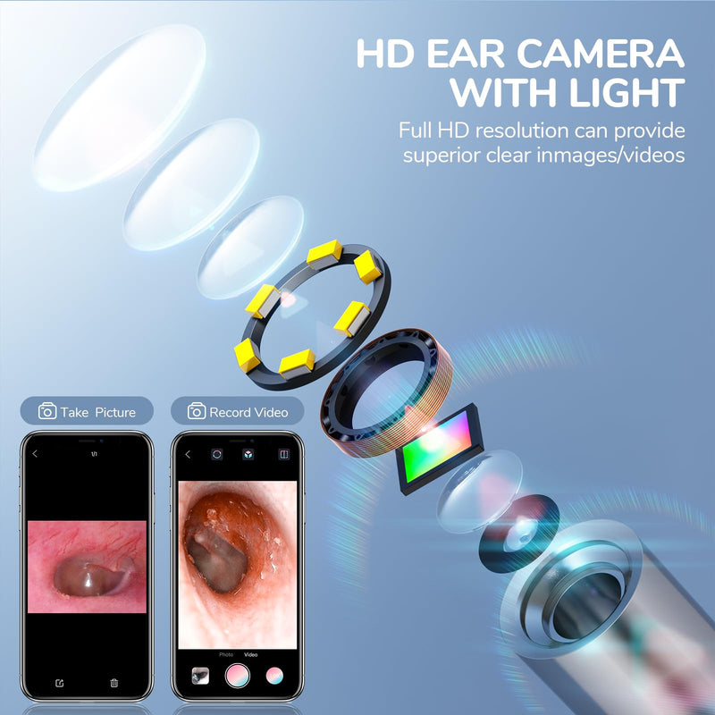 Otoscope Compatible with iPhone 15/Android, ScopeAround 3.9mm Ultra-Thin Ear Camera with 6 LED Lights,Digital Otoscope with Ear Wax Removal Tool,USB Plug & Play Ear Wax Camera for Android