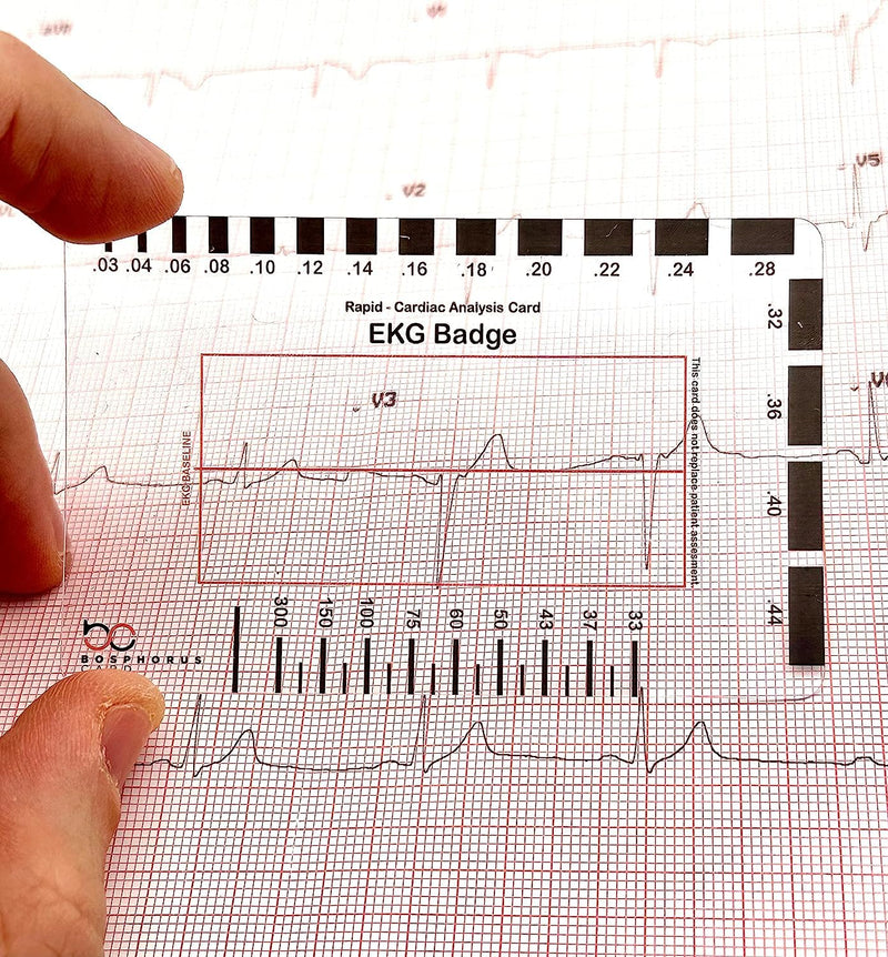 [Australia - AusPower] - EKG PVC Badge Card – Accurately Interpret ECG/EKG Rhythm Strips and 12 Lead EKG Without EKG Calipers – for Nurse NHS or Anyone in Healthcare! 