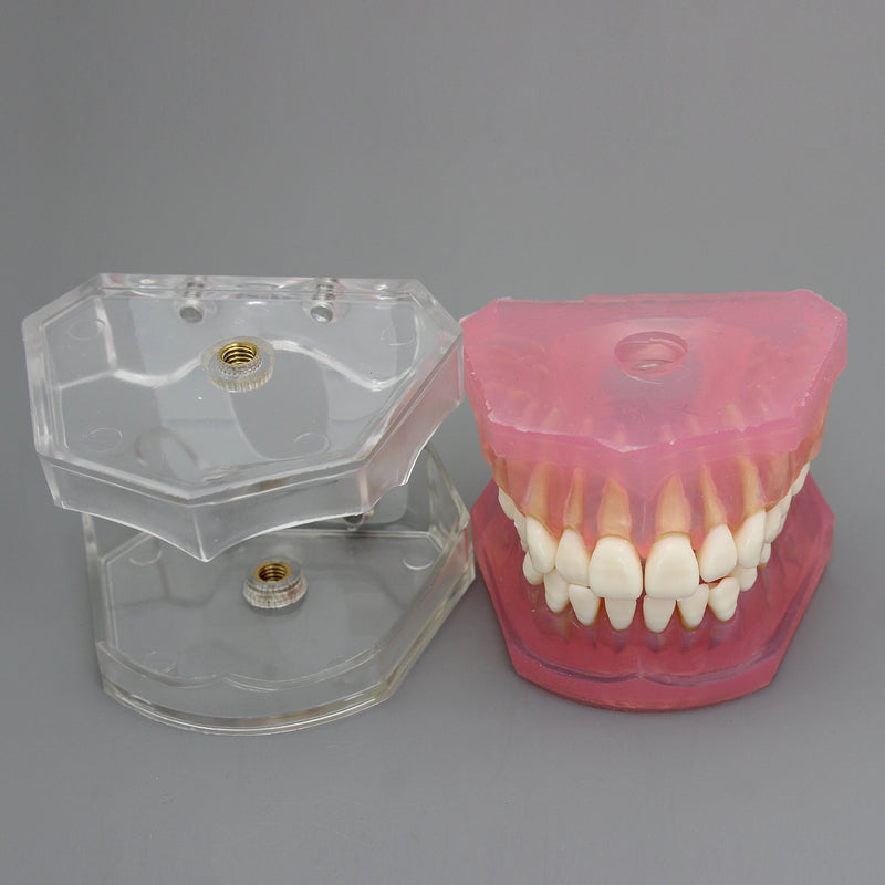 [Australia - AusPower] - Dental Implant Teeth Model Study Teach Standard Model with Removable Teeth 