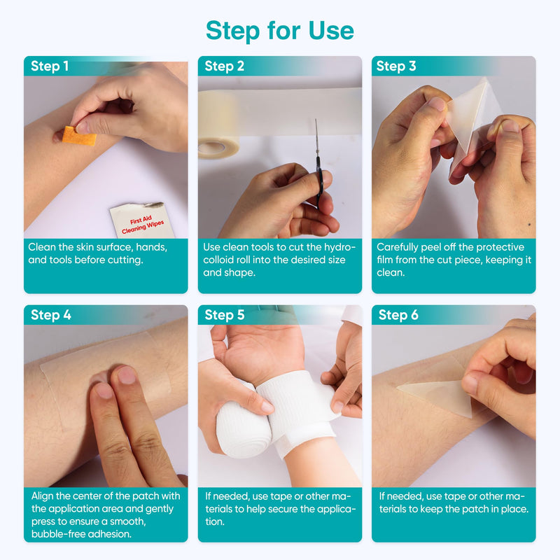 Derm Tape Hydrocolloid Roll - Acne & Pimple Patch Tape, Flexible Bandages Roll for Wound Care and Skin Protection, Cut-to-Size Hydrocolloid Tape for Daily Use (2in x 16ft) 2in*16ft*1pc