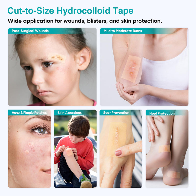 Derm Tape Hydrocolloid Roll - Acne & Pimple Patch Tape, Flexible Bandages Roll for Wound Care and Skin Protection, Cut-to-Size Hydrocolloid Tape for Daily Use (2in x 16ft) 2in*16ft*1pc