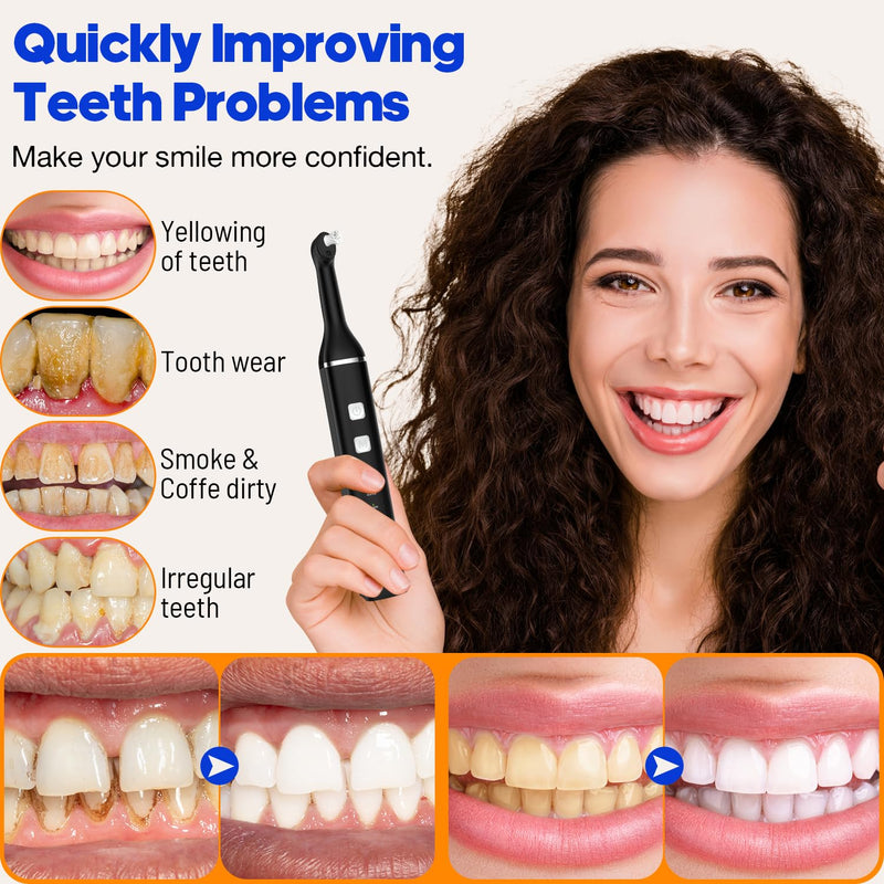 [Australia - AusPower] - Tooth Polisher, RRZIOM Rechargeable Teeth Polisher for Teeth Whitening and Cleaning Kit, Waterproof Tooth Polish Dental Tools with LED Light, 5 Brush Heads, 5 Speed Modes, Tooth Polishing Kit Black-1 