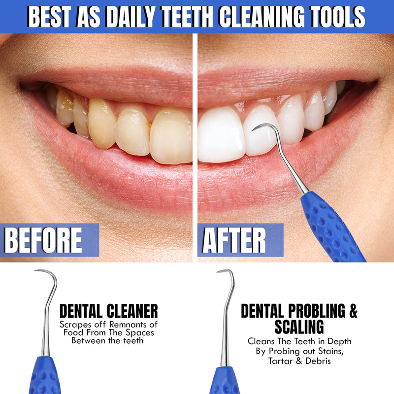 [Australia - AusPower] - Professional Dental Tools Tartar Scraper For Dentist, Personal and Pets Use Plaque Remover With Comfortable Grip, Double ended Silicon Grip Scaler 