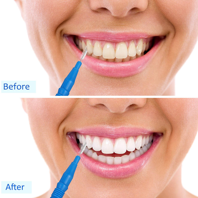 [Australia - AusPower] - 100 Pieces Braces Dental Brush Flosser for Cleaner Interdental Brush Toothpick Dental Tooth Flossing Head Oral Dental Hygiene Toothpick Cleaners Cleaning Tool(Red and Blue) Red and Blue 