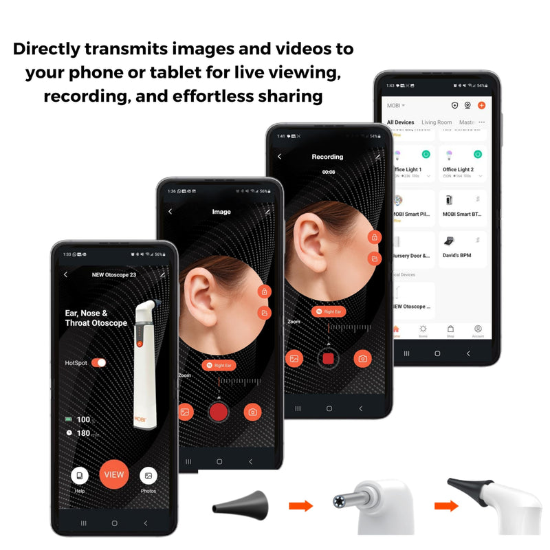 [Australia - AusPower] - MOBI Connect Wi-Fi Otoscope for Ears, Nose & Throat - 1080P HD Lens, Multi-Axis Gyroscope, 6 LED Lights, 90+ Min Use, 3 Ear Speculum, Suitable for Adults & Children 