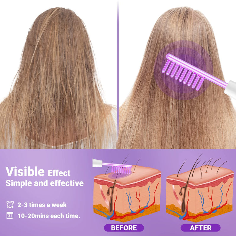 [Australia - AusPower] - High Frequency Facial Wand-UUPAS Portable Handheld High Frequency Facial Machine Skin Facial Wand with 4 Violet Tubes 