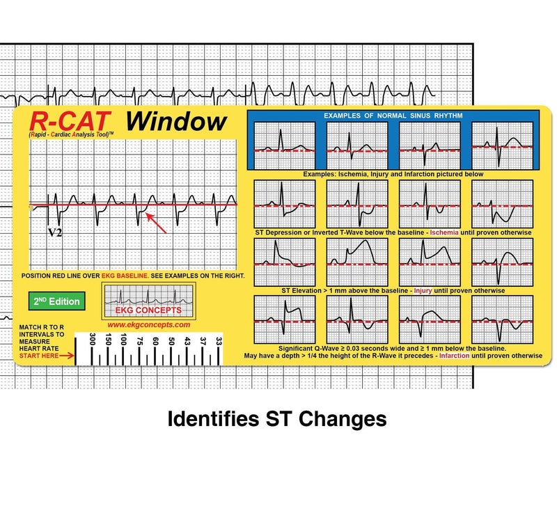 [Australia - AusPower] - R-CAT EKG Window 2nd Edition 