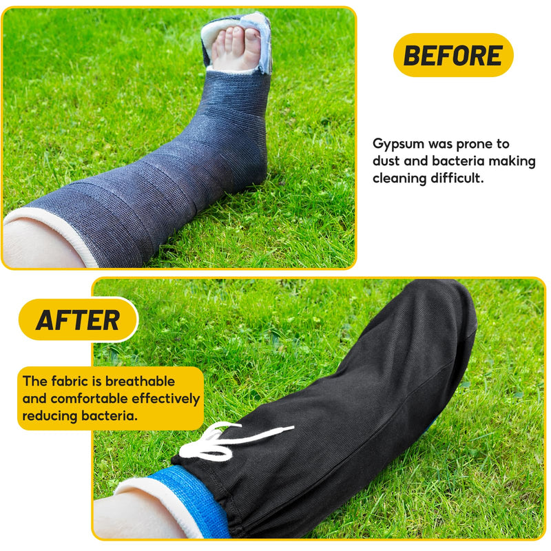 [Australia - AusPower] - Max Shape Washable Leg Cast Cover, Adjustable Knee Sock for Men & Women, Medium Short Foot Cover (Black+Black) Black+black 