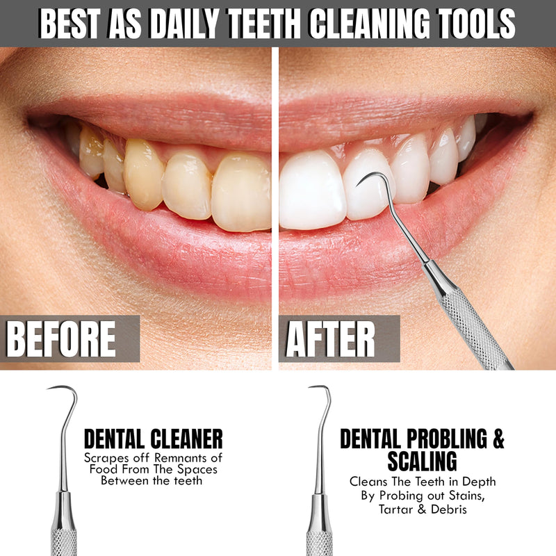 [Australia - AusPower] - Professional Dental Tools |Tartar Scraper For Dentist, Personal Use and Pets | Plaque Remover For Teeth, Premium Oral Care Double ended Hollow Scaler | U5/33 Japanese Stainless Steel 
