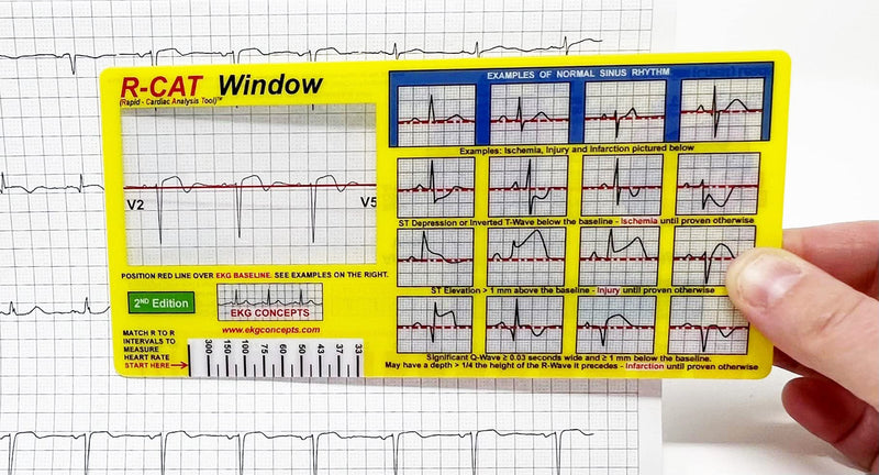 [Australia - AusPower] - R-CAT EKG Window 2nd Edition 