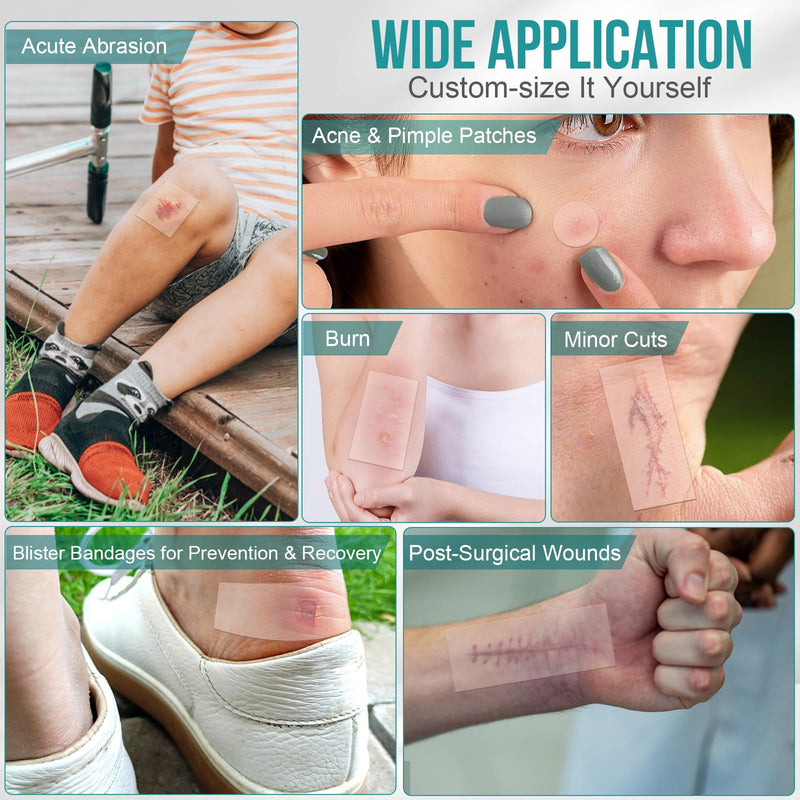 [Australia - AusPower] - Hydrocolloid Roll for Wound Care, Hydrocolloid Patch Bandages with Self-Adhesive, Bed Sore Bandages, Highly Absorbent for Burn, Blister, Acne Care, Sterile and Waterproof (2in x 12ft) 